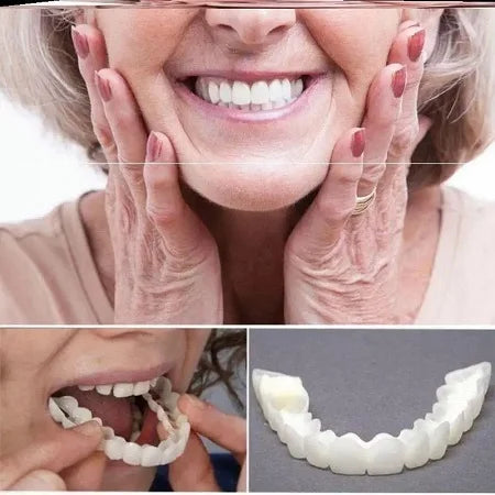 Carillas Dentales