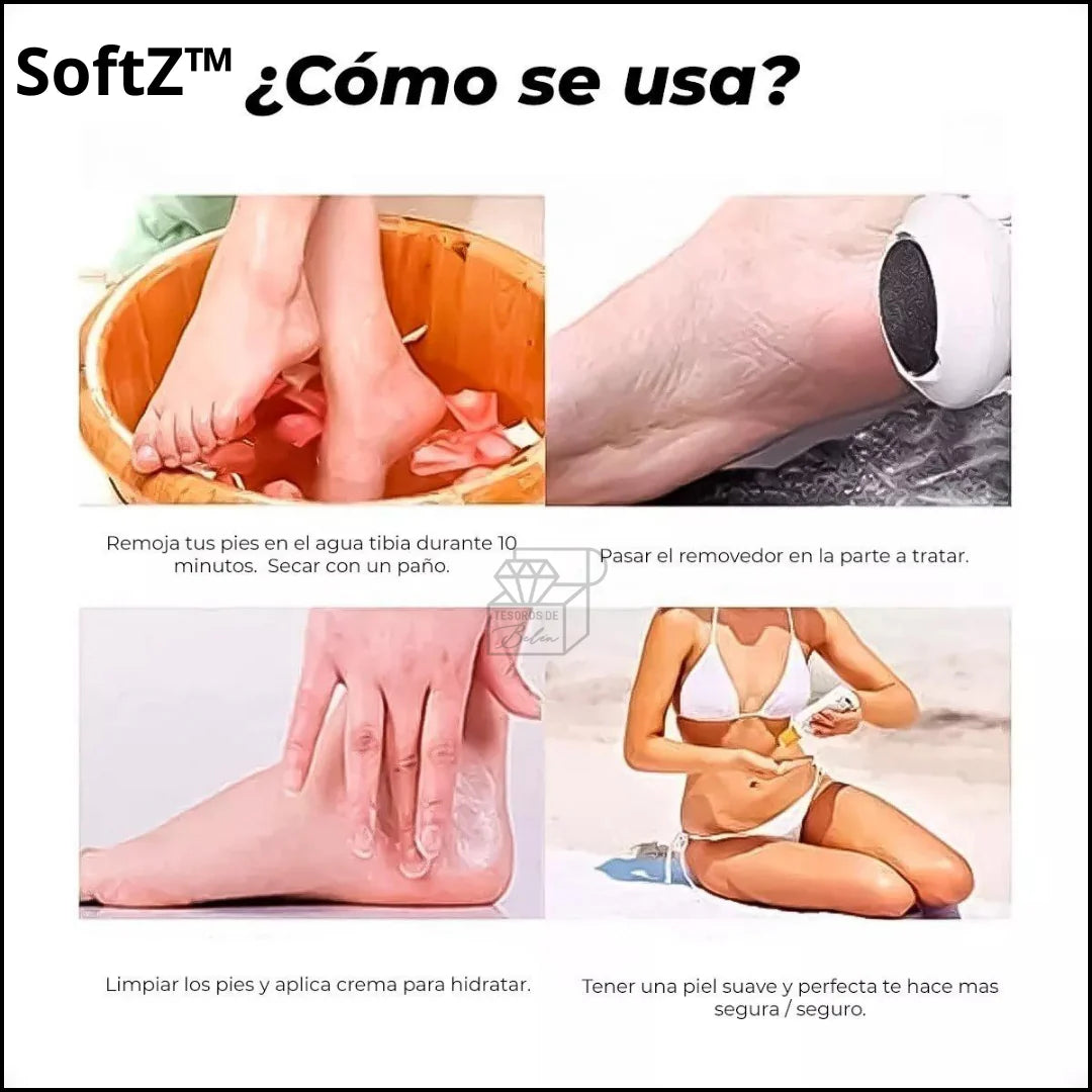 SoftZ™Removedor de callos🦶